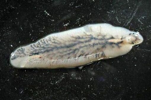 Leberegel beim Menschen