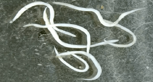 Madenwürmer im menschlichen Körper