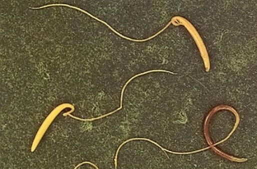 Peitschenwurm des menschlichen Körpers