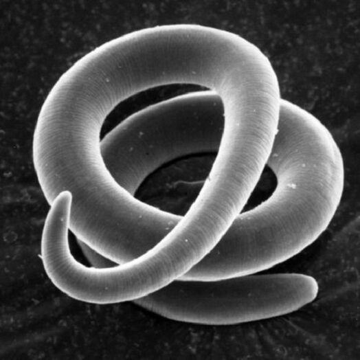 Trichinella-parasitärer Wurm beim Menschen