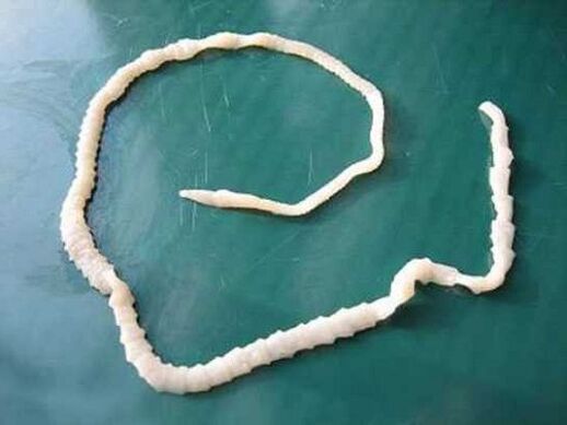 menschlicher Schweinebandwurm