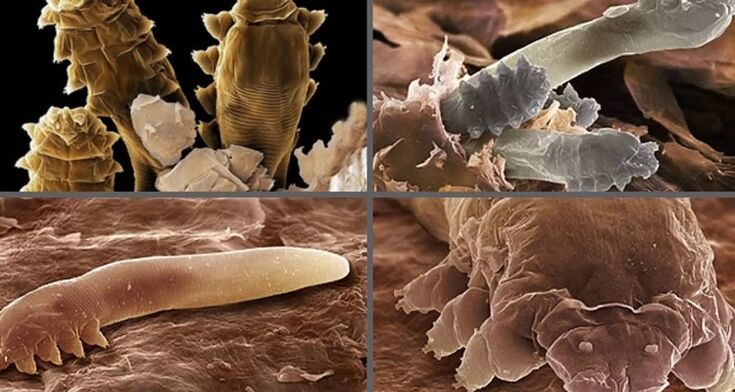 Arten menschlicher Hautparasiten