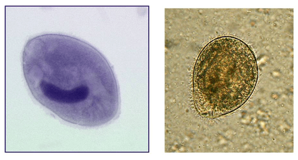 Balantidia Ciliaten, Parasiten des Dickdarms